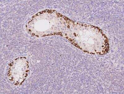 Immunohistochemistry-Paraffin: STK31 Antibody [NBP3-05887]