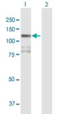 Western Blot: STK31 Antibody [H00056164-B01P]