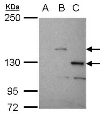 Western Blot: STK31 Antibody [NBP2-19305]