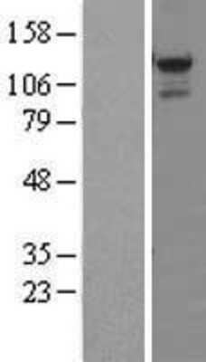 Western Blot: STK31 Overexpression Lysate [NBL1-16548]