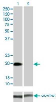 Western Blot: STK32A Antibody (3E8-1D3) [H00202374-M01]