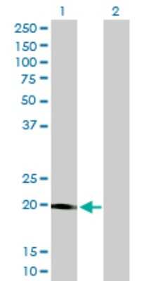 Western Blot: STK32A Antibody (3E8-1D3) [H00202374-M01]