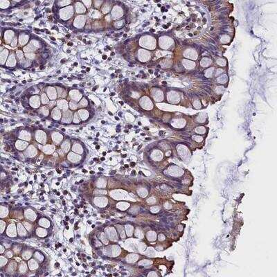 Immunohistochemistry-Paraffin: STK32A Antibody [NBP1-82735]