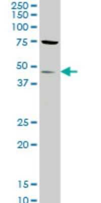 Western Blot: STK32C Antibody (3B4) [H00282974-M02]