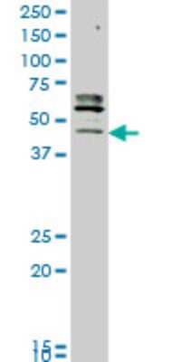 Western Blot: STK32C Antibody (3E8) [H00282974-M05]