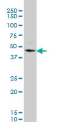 Western Blot: STK32C Antibody (4D12) [H00282974-M03]