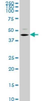 Western Blot: STK32C Antibody (4G2) [H00282974-M08]