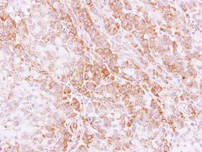 Immunohistochemistry-Paraffin: STK32C Antibody [NBP1-33507]