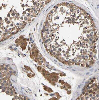 Immunohistochemistry-Paraffin: STK32C Antibody [NBP1-82732]