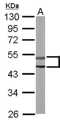 Western Blot: STK32C Antibody [NBP1-33507]