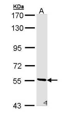 Western Blot: STK32C Antibody [NBP1-33507]