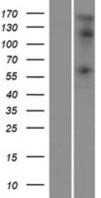 Western Blot: STK32C Overexpression Lysate [NBP2-05121]