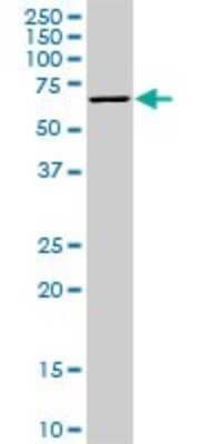 Western Blot: STK33 Antibody (1F10) [H00065975-M09]