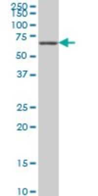 Western Blot: STK33 Antibody (1F10) [H00065975-M09]