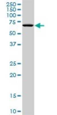 Western Blot: STK33 Antibody (1F10) [H00065975-M09]