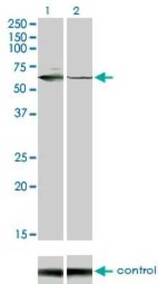 Western Blot: STK33 Antibody (6G1) [H00065975-M02]