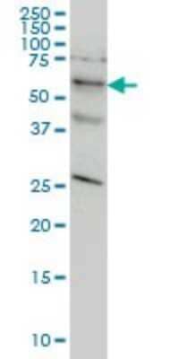 Western Blot: STK33 Antibody (6G1) [H00065975-M02]