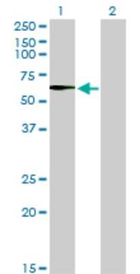Western Blot: STK33 Antibody (6G1) [H00065975-M02]