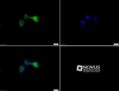 Immunocytochemistry/ Immunofluorescence: STK33 Antibody - BSA Free [NBP1-54156]