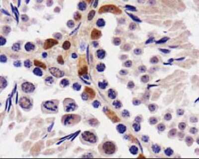 Immunohistochemistry: STK33 Antibody - BSA Free [NBP1-54156]