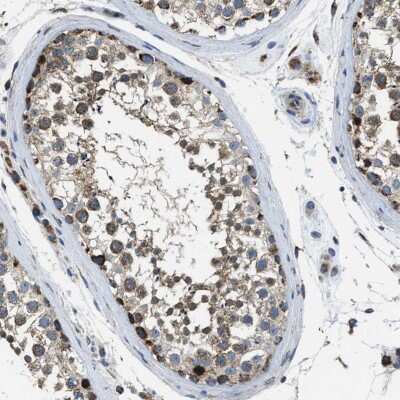 Immunohistochemistry-Paraffin: STK33 Antibody [NBP1-86069]