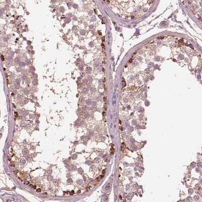Immunohistochemistry-Paraffin: STK33 Antibody [NBP2-58674]