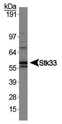 Western Blot: STK33 AntibodyBSA Free [NBP1-54156]