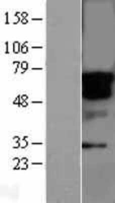 Western Blot: STK33 Overexpression Lysate [NBL1-16551]