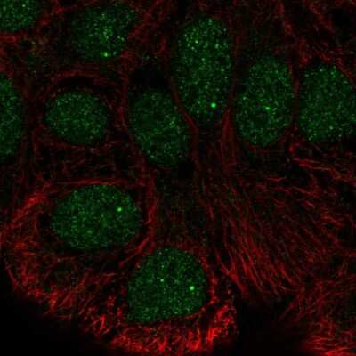 Immunocytochemistry/ Immunofluorescence: STK35 Antibody [NBP2-55292]