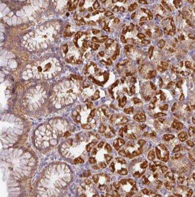 Immunohistochemistry: STK35 Antibody [NBP2-30644]