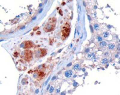 Immunohistochemistry-Paraffin: STK35 Antibody [NB100-1393]