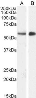 Western Blot: STK35 Antibody [NB100-1393]