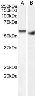 Western Blot: STK35 Antibody [NB100-1393]