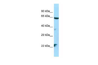 Western Blot: STK35 Antibody [NBP2-88372]