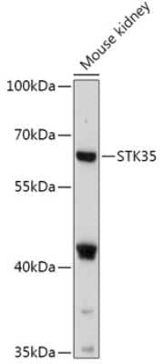 Western Blot: STK35 AntibodyAzide and BSA Free [NBP2-94423]