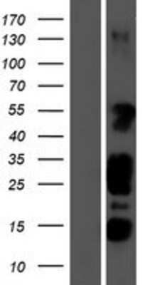 Western Blot: STK35 Overexpression Lysate [NBP2-10235]