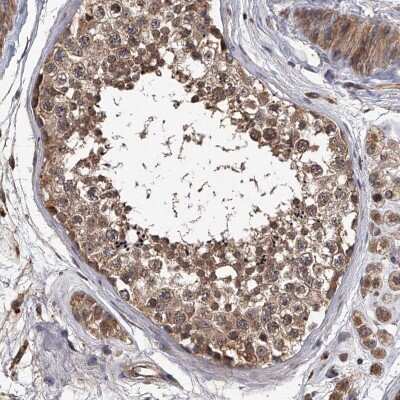 Immunohistochemistry-Paraffin: STK36 Antibody [NBP1-83410]