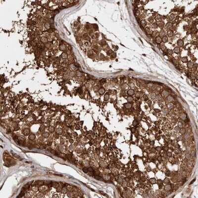Immunohistochemistry-Paraffin: STK36 Antibody [NBP1-83411]