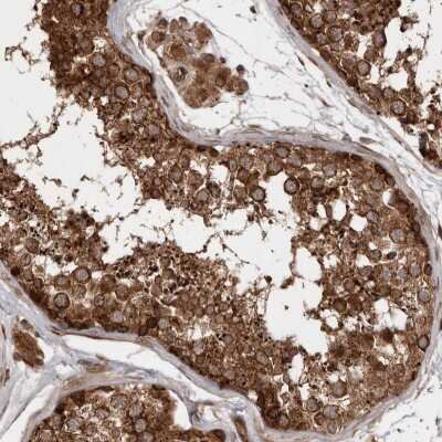 Immunohistochemistry-Paraffin: STK36 Antibody [NBP1-83412]