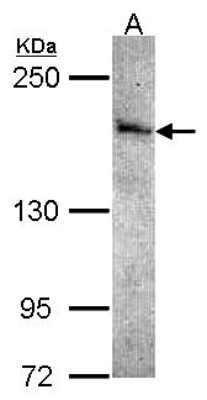 Western Blot: STK36 Antibody [NBP2-20517]