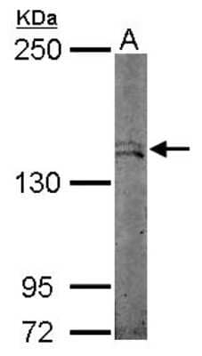 Western Blot: STK36 Antibody [NBP2-20517]