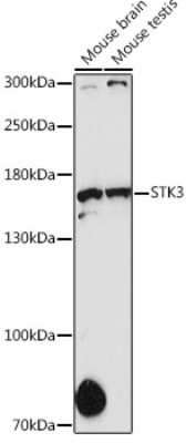 Western Blot: STK36 AntibodyAzide and BSA Free [NBP3-15339]