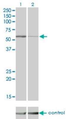 Western Blot: STK38 Antibody (2F3) [H00011329-M04]