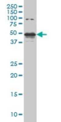 Western Blot: STK38 Antibody (2F3) [H00011329-M04]
