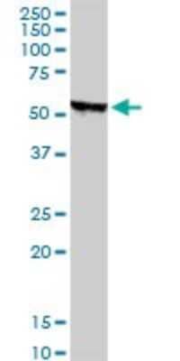 Western Blot: STK38 Antibody (2G8-1F3) [H00011329-M01]