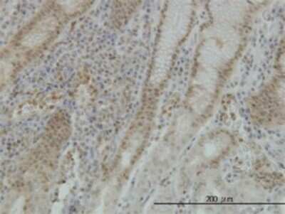 Immunohistochemistry-Paraffin: STK38 Antibody (3A5) [H00011329-M02]