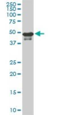 Western Blot: STK38 Antibody (3A5) [H00011329-M02]