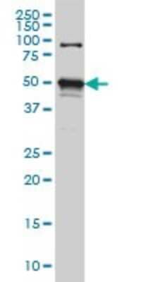 Western Blot: STK38 Antibody (3A5) [H00011329-M02]