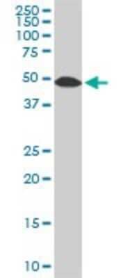 Western Blot: STK38 Antibody (3A5) [H00011329-M02]