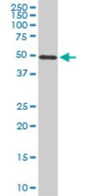 Western Blot: STK38 Antibody (3A5) [H00011329-M02]